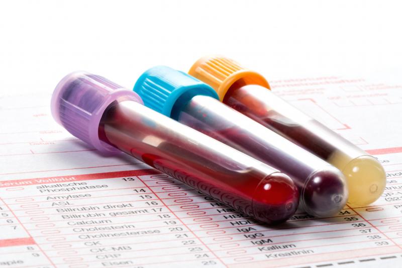 Платные анализы крови для детей в москве